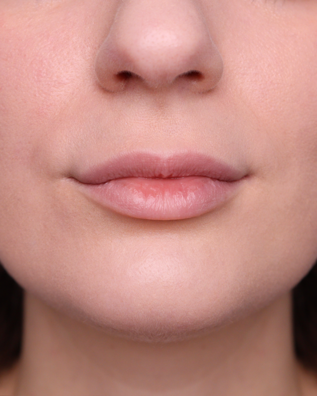 Collagen More - Gloss Volumizzante Skin Proof
